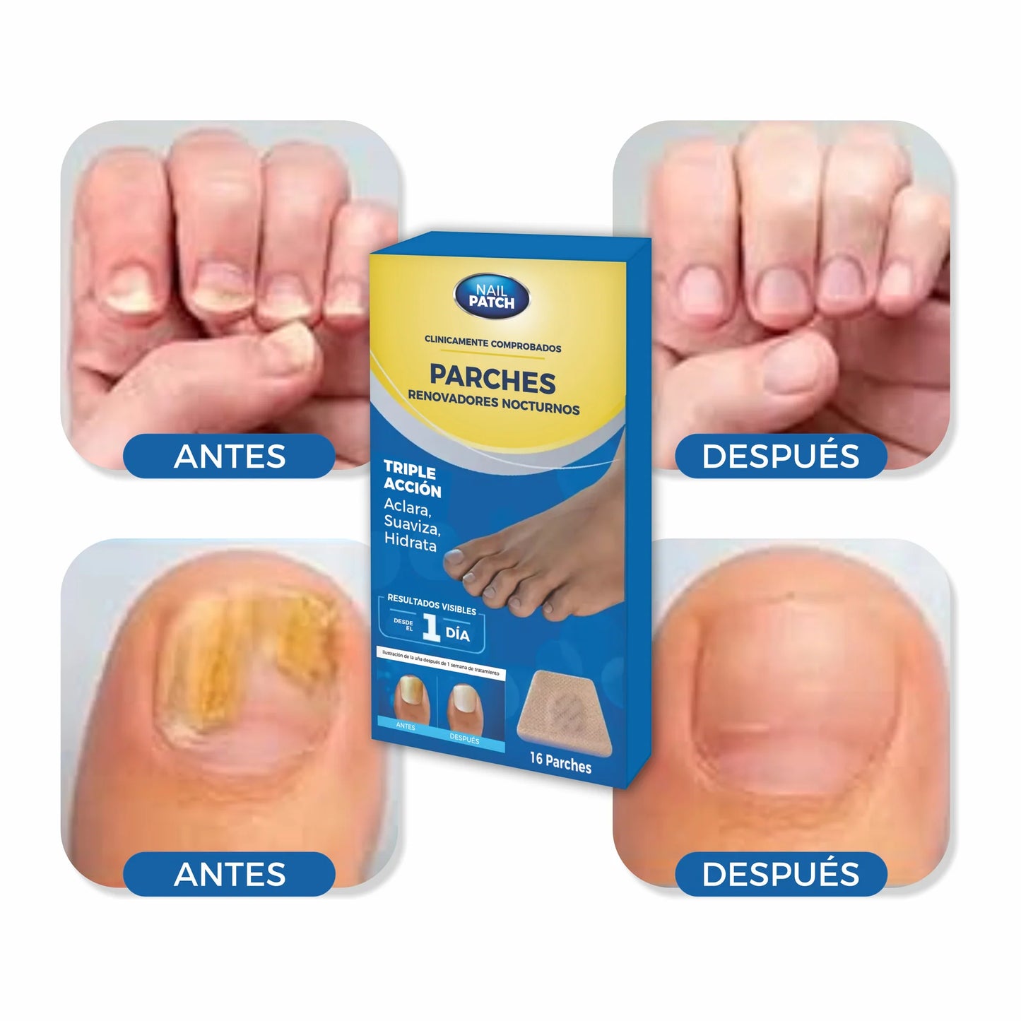 Parches ANTI-HONGO - combate hongos, aclara y refuerza tus uñas