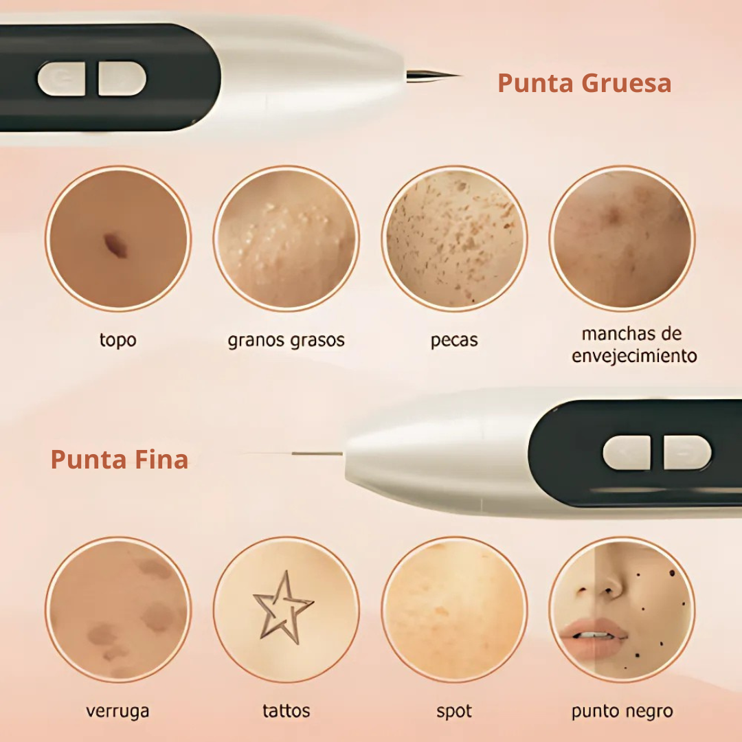 Láser para la Piel - Para Verrugas y Lunares - Cuida tu Piel sin Dolor desde el Día 1