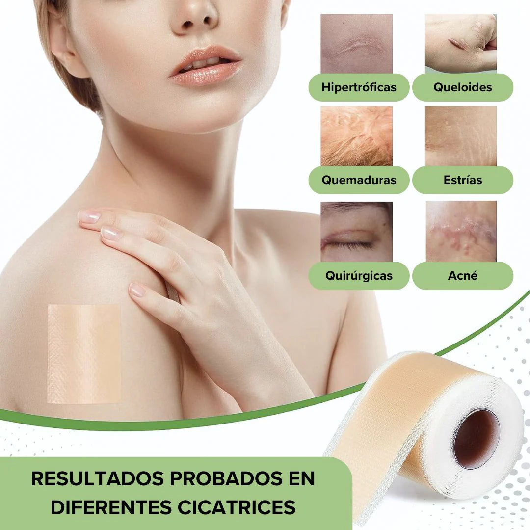 ROLLO DE CINTA DE SILICONA - Mejora la apariencia de tus cicatrices