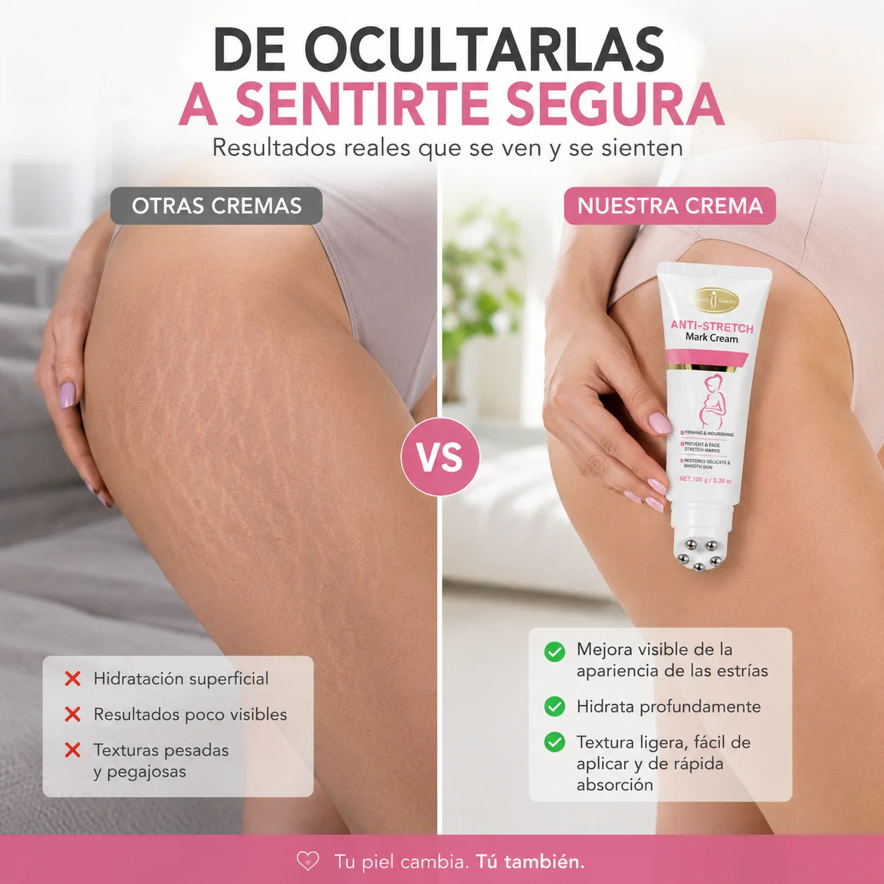 Piel Lisa Roll-On - Mejora la apariencia de estrías