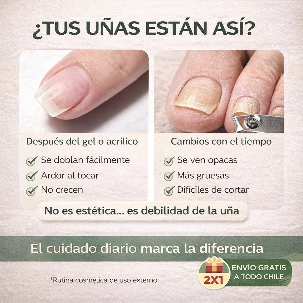 VITANAILS de queratina, tratamiento para uñas de manos y pies, cuidado diario saludable