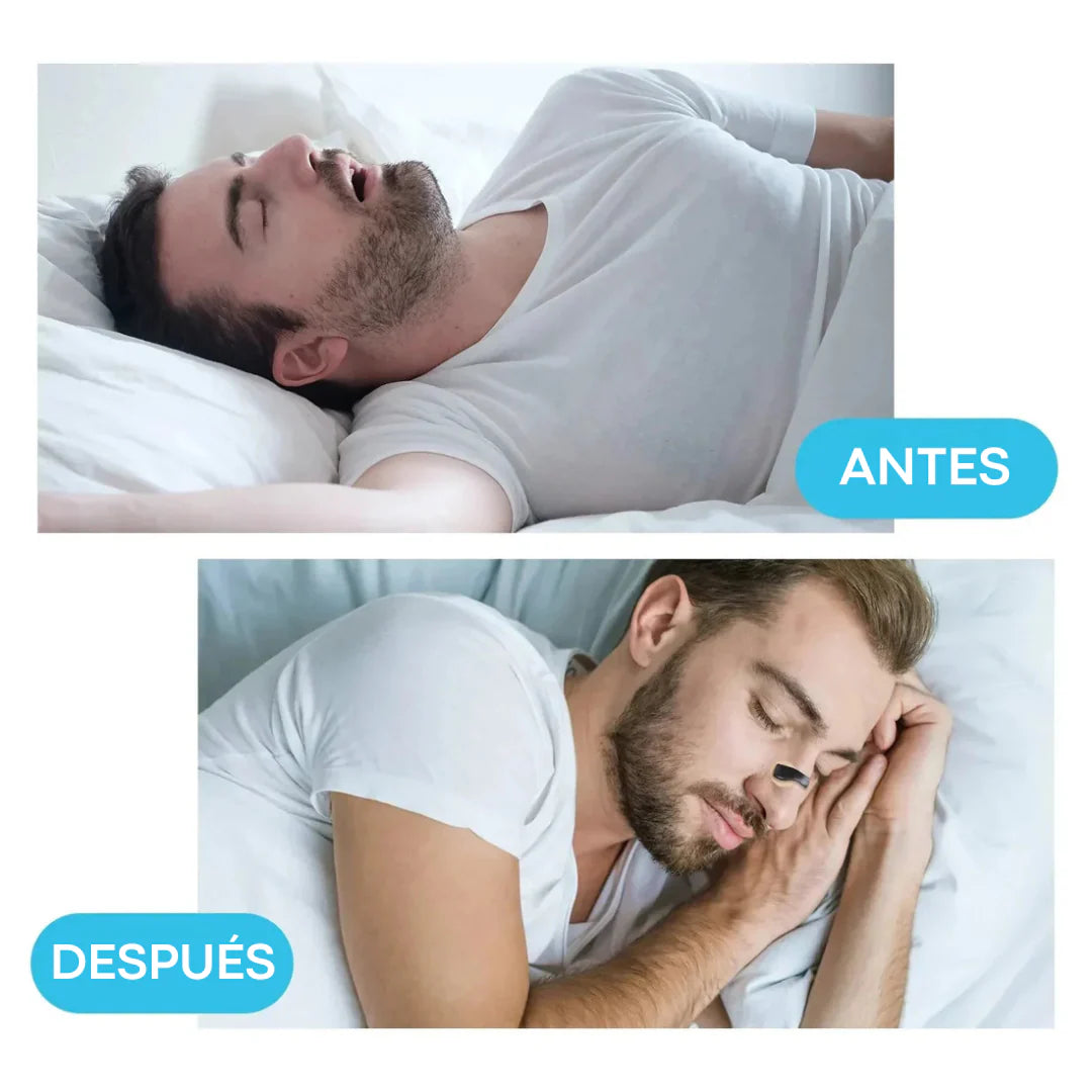Dispositivo Nasal – Abre tus vías de aire – Despierta renovado cada mañana