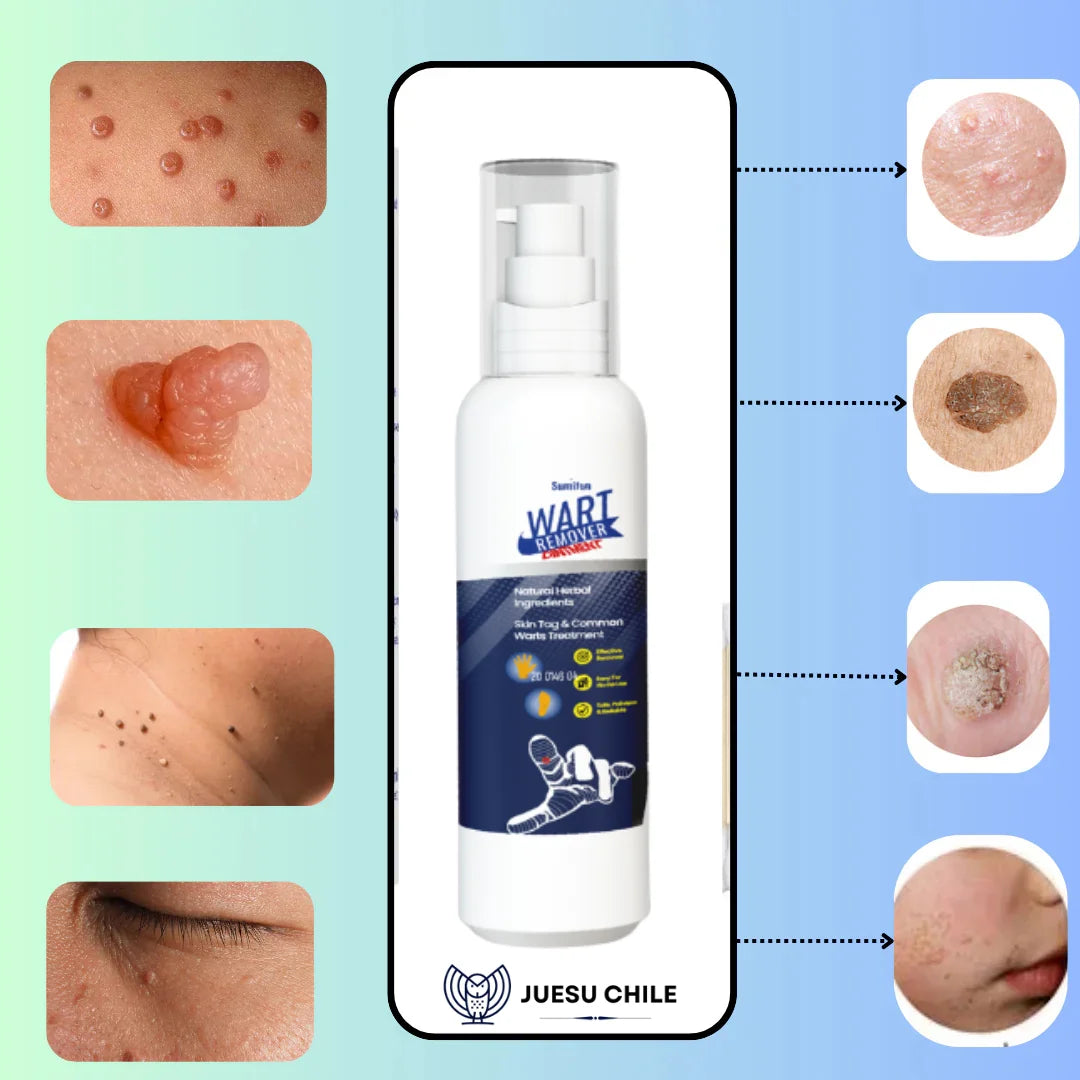 Wart Remover– Remueve Verrugas Fácil – Recupera tu confianza sin dolor en casa