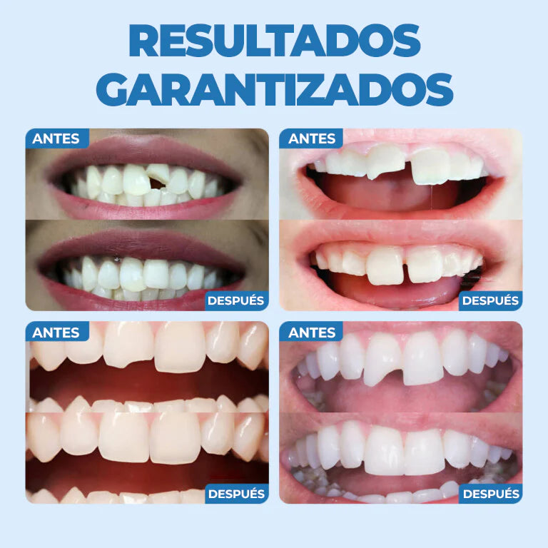 Kit Dental – Cubre espacios al instante – Sonríe con confianza en minutos